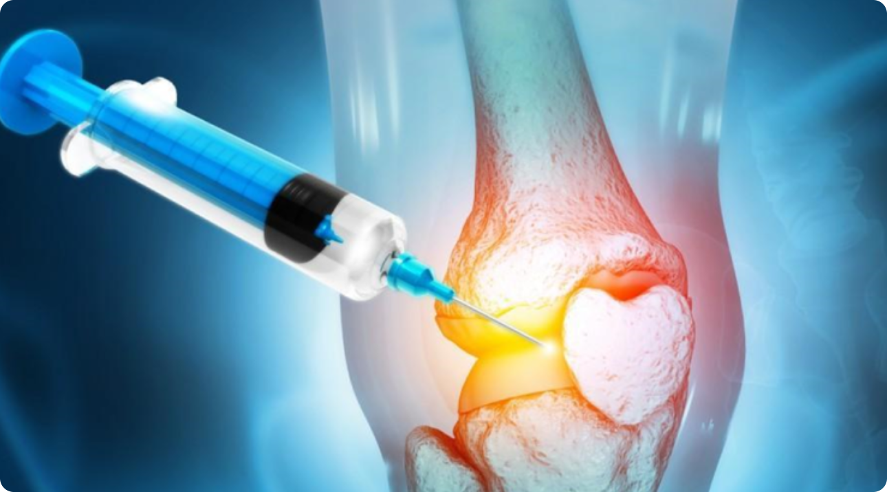 Best Orthobiology Treatment in Hyderabad 